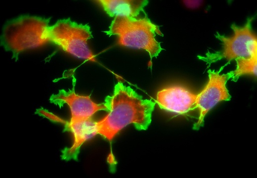 Mehrfachfluoreszenzmarkierung: Zellkerne (violett) und Zellskelettelemente (Aktin rot, Myosin gr&#252;n) 