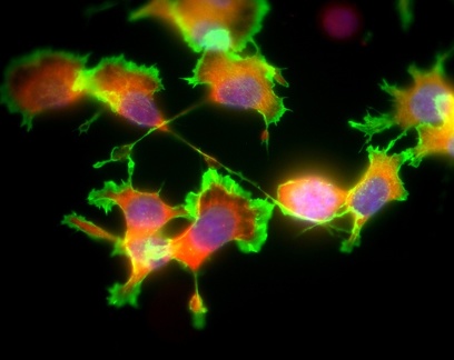 Mehrfachfluoreszenzmarkierung: Zellkerne (violett) und Zellskelettelemente (Aktin rot, Myosin grün) 